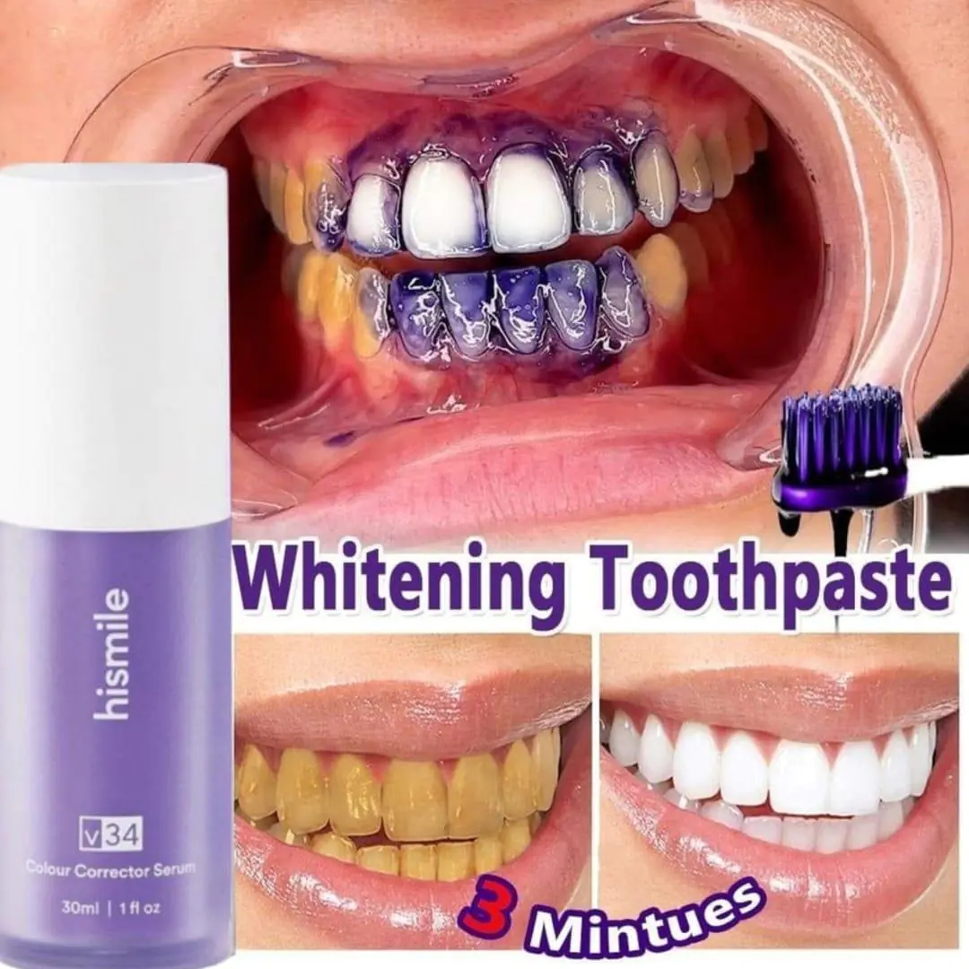 Hismile Teeth Whitening Toothpaste